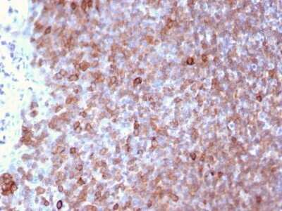 Immunohistochemistry-Paraffin: LSP1 Antibody (LSP1/3025) - Azide and BSA Free [NBP2-79859]