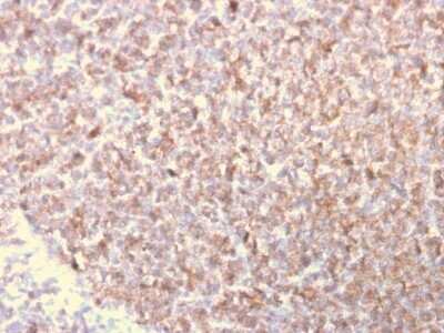 Immunohistochemistry-Paraffin: LSP1 Antibody (LSP1/3025) - Azide and BSA Free [NBP2-79859]