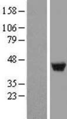 Western Blot: LSP1 Overexpression Lysate [NBL1-12732]