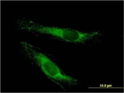 Immunocytochemistry/ Immunofluorescence: LSS Antibody (2E4) [H00004047-M01]