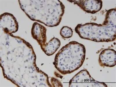 Immunohistochemistry-Paraffin: LSS Antibody (2E4) [H00004047-M01]