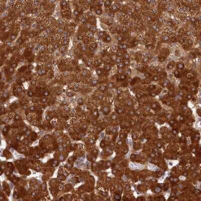 Immunohistochemistry-Paraffin: LSS Antibody [NBP1-82474]