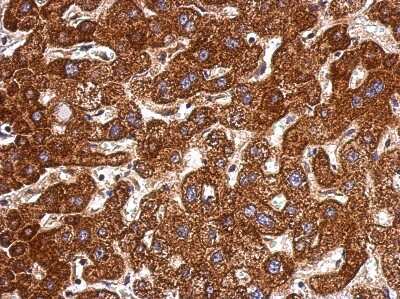 Immunohistochemistry-Paraffin: LSS Antibody [NBP2-17184]