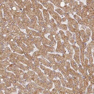 Immunohistochemistry-Paraffin: LSS Antibody [NBP2-33966]