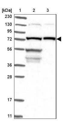 Western Blot: LSS Antibody [NBP1-82474]