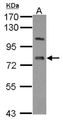 Western Blot: LSS Antibody [NBP2-17184]