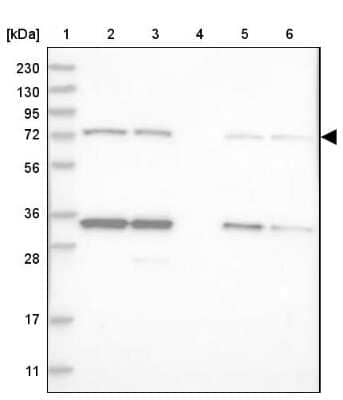 Western Blot: LSS Antibody [NBP2-33966]