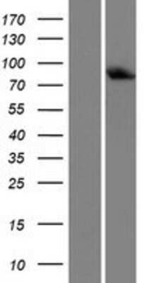 Western Blot: LSS Overexpression Lysate [NBP2-08981]