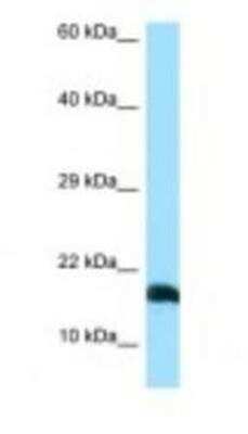 Western Blot: LST1 Antibody [NBP1-98482]