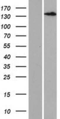 Western Blot: LTBP3 Overexpression Lysate [NBP2-09509]