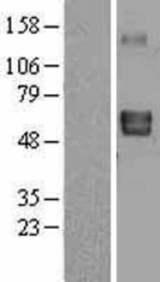 Western Blot: Lymphotoxin beta R/TNFRSF3 Overexpression Lysate [NBL1-12740]