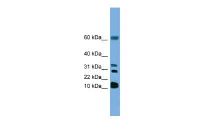 Western Blot: LTC4S Antibody [NBP1-69315]