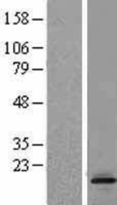 Western Blot: LTC4S Overexpression Lysate [NBL1-12741]