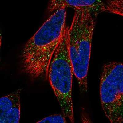 Immunocytochemistry/ Immunofluorescence: LTK Antibody [NBP2-32475]