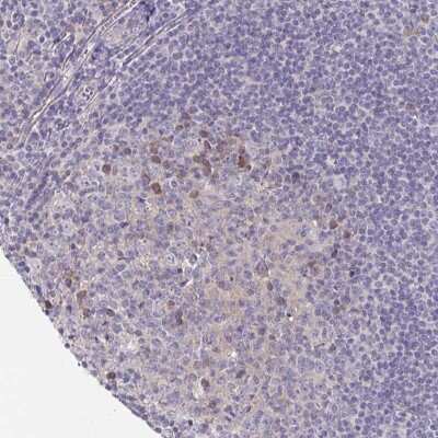 Immunohistochemistry-Paraffin: LTK Antibody [NBP2-32475]