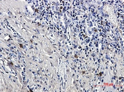 Immunohistochemistry-Paraffin: LTK Antibody (S02-8A4) [NBP3-19886]