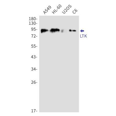 Western Blot: LTK Antibody (S02-8A4) [NBP3-19886]