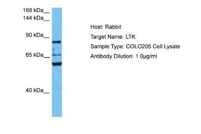 Western Blot: LTK Antibody [NBP2-87756]