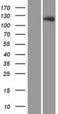 Western Blot: LTK Overexpression Lysate [NBP2-08125]