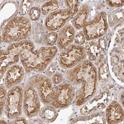 Immunohistochemistry-Paraffin: LTV1 Antibody [NBP1-86733]