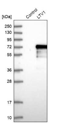 Western Blot: LTV1 Antibody [NBP1-86735]