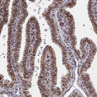 Immunohistochemistry-Paraffin: LUC7L Antibody [NBP2-56401]