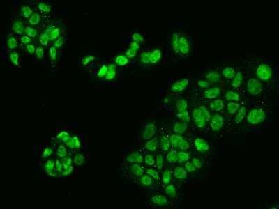 Immunocytochemistry/ Immunofluorescence: LUC7L2 Antibody [NBP3-06338]