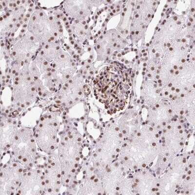 Immunohistochemistry-Paraffin: LUC7L2 Antibody [NBP2-33621]