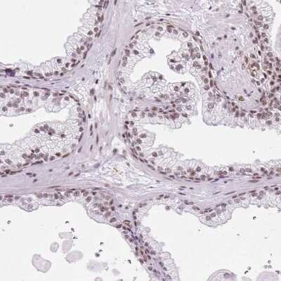 Immunohistochemistry-Paraffin: LUC7L2 Antibody [NBP2-33621]