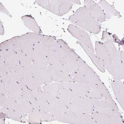 Immunohistochemistry-Paraffin: LUC7L2 Antibody [NBP2-33621]