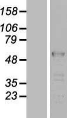 Western Blot: LUC7L2 Overexpression Lysate [NBL1-12744]