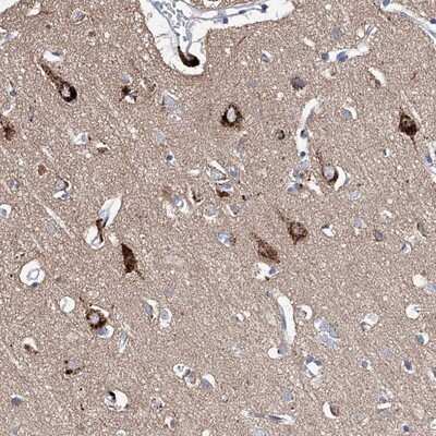 Immunohistochemistry-Paraffin: LURAP1 Antibody [NBP1-83568]