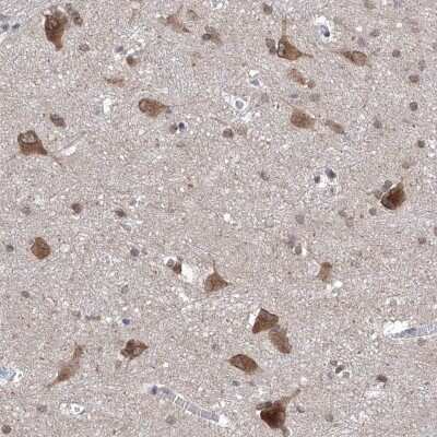 Immunohistochemistry-Paraffin: LURAP1 Antibody [NBP1-83569]