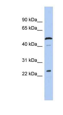 Western Blot: LURAP1 Antibody [NBP1-56823]