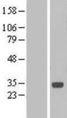 Western Blot: LURAP1 Overexpression Lysate [NBL1-08309]