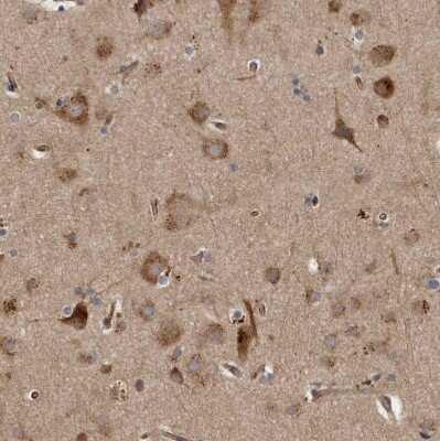 Immunohistochemistry-Paraffin: LUZP1 Antibody [NBP1-81281]