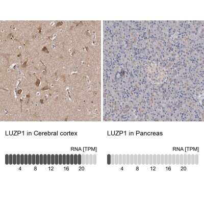 Immunohistochemistry-Paraffin: LUZP1 Antibody [NBP1-81282]