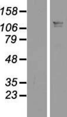 Western Blot: LUZP1 Overexpression Lysate [NBP2-05873]