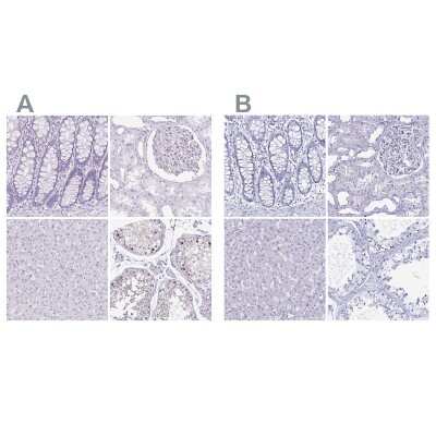 Immunohistochemistry-Paraffin: LUZP4 Antibody [NBP1-94093]