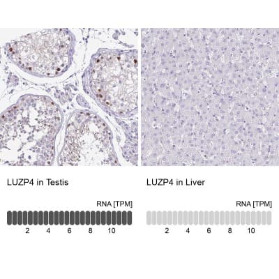 Immunohistochemistry-Paraffin: LUZP4 Antibody [NBP1-94093]