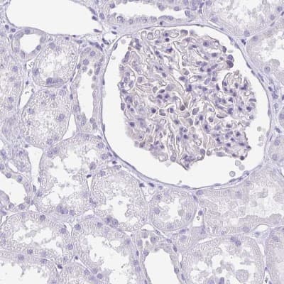 Immunohistochemistry-Paraffin: LUZP4 Antibody [NBP1-94093]