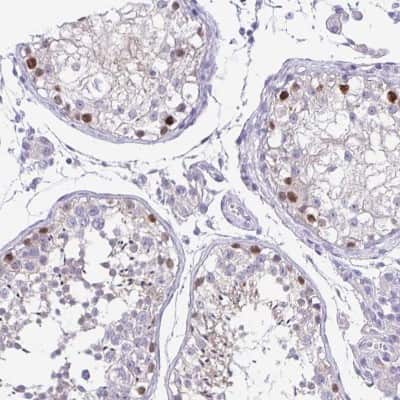 Immunohistochemistry-Paraffin: LUZP4 Antibody [NBP1-94093]
