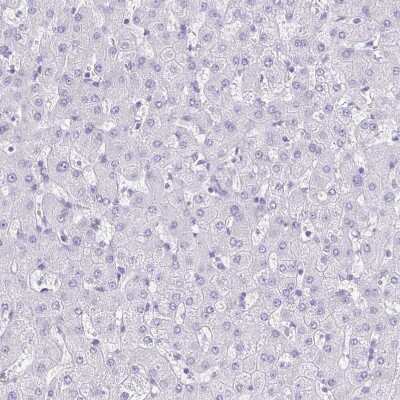 Immunohistochemistry-Paraffin: LUZP4 Antibody [NBP1-94093]