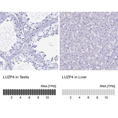Immunohistochemistry-Paraffin: LUZP4 Antibody [NBP2-33634]