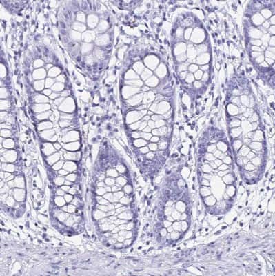 Immunohistochemistry-Paraffin: LUZP4 Antibody [NBP2-33634]