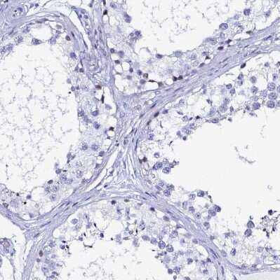 Immunohistochemistry-Paraffin: LUZP4 Antibody [NBP2-33634]