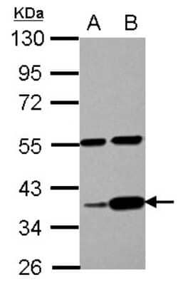 Western Blot: LUZP4 Antibody [NBP2-17185]