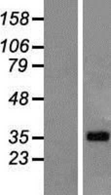 Western Blot: LUZP4 Overexpression Lysate [NBP2-07043]