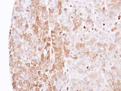 Immunohistochemistry-Paraffin: Latexin Antibody [NBP1-32525]