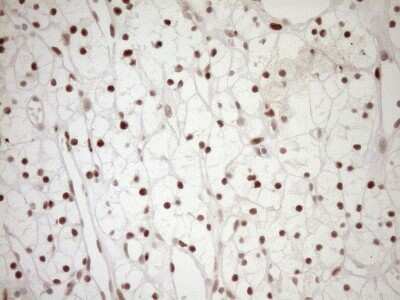 Immunohistochemistry: LXR alpha/NR1H3 Antibody (OTI1A5) [NBP2-46220]